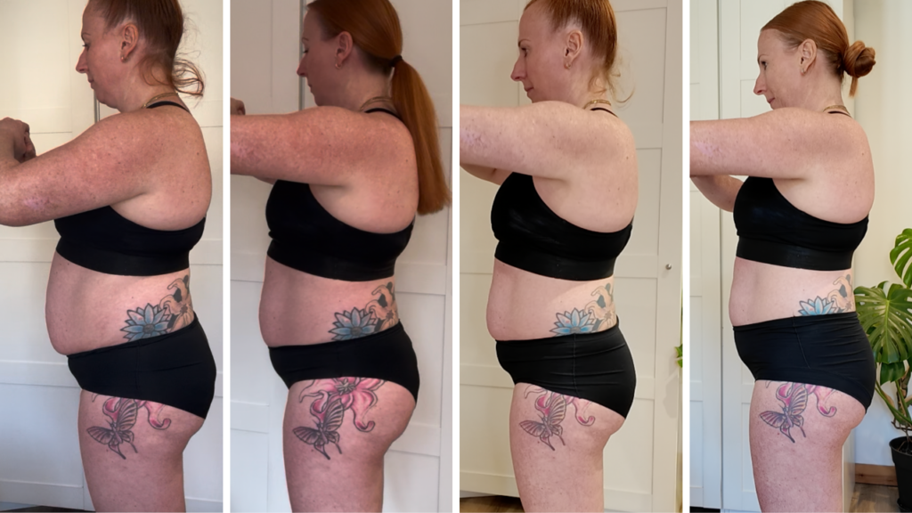 mounjaro before after 3 month results side