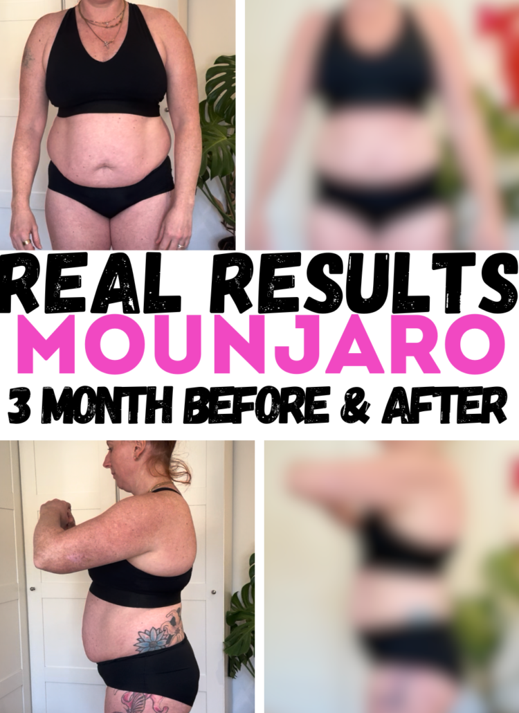 mounjaro before & after 3 months